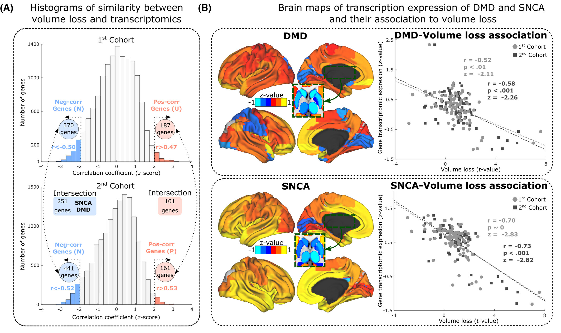 Transcriptional Signatures of Synaptic Vesicle Genes Define Myotonic Dystrophy Type I Neurodegeneration